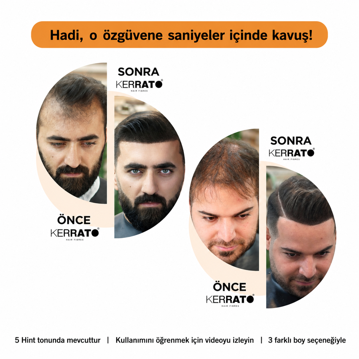Kerrato Hair Fibers