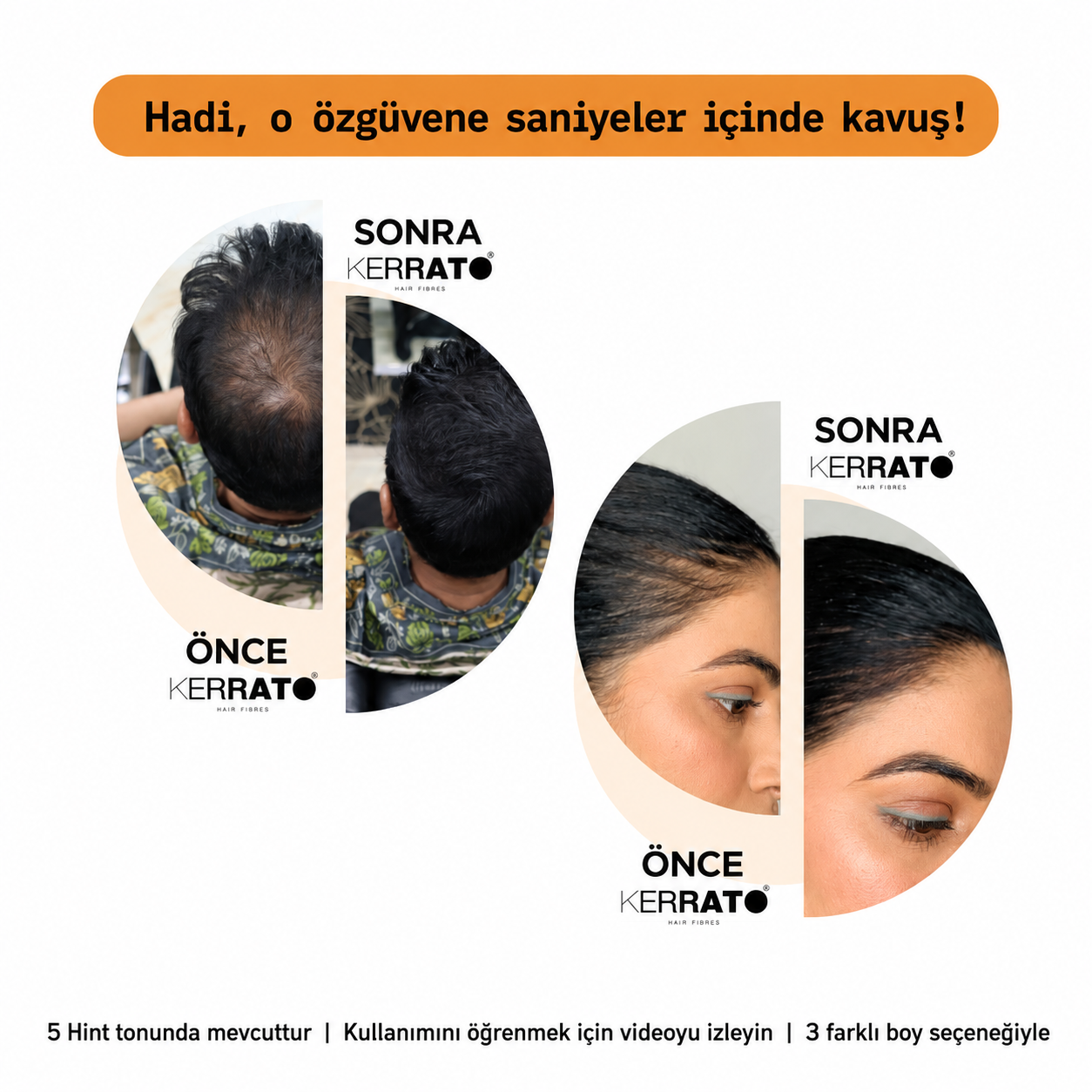 Kerrato Hair Fibers